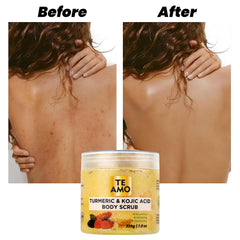 Body Scrub - Turmeric & Kojic 7.8 oz by Te Amo