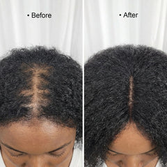 Hair Growth Serum Roll-On 2% Anagain, Argan & Rosemary by Te Amo