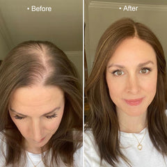 Hair Growth Serum Roll-On 2% Anagain, Argan & Rosemary by Te Amo
